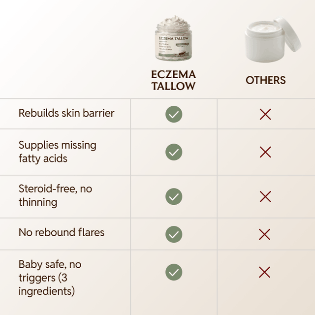Eczema Tallow Skin Soothing Cream